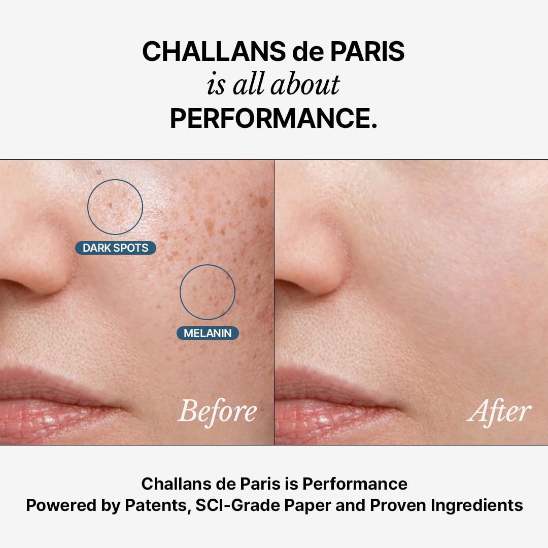 CHALLANS DE PARIS Anti-Mela Complex bottle label highlighting key actives for even tone
