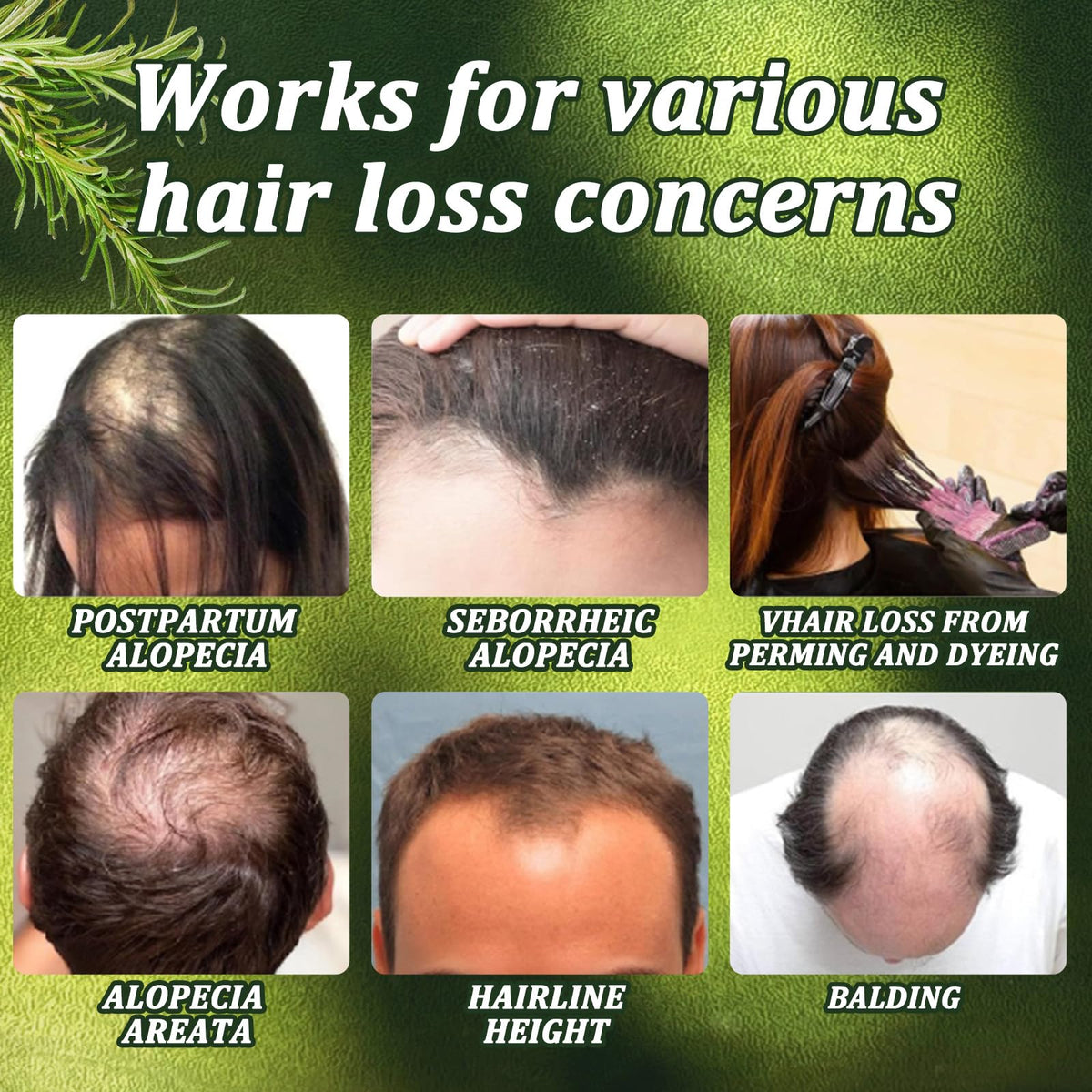 Chambelza rosemary shampoo on a bathroom shelf, implying daily use for thinning hair support.