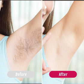 Charmonic wax refills for efficient, ready-to-use waxing sessions.