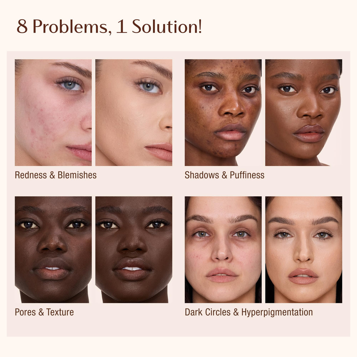 Charlotte Tilbury AIRbrush Flawless Blur Concealer micro-dot tip enables precision.