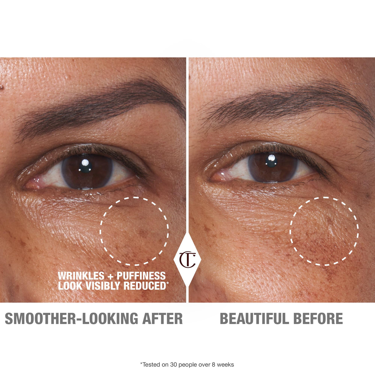 Cryo-Recovery Eye Serum targets the eye contour to reduce puffiness.