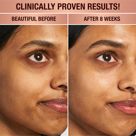 Charlotte Tilbury Magic Eye Rescue applied along the orbital bone for lift