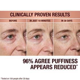 Charlotte Tilbury brighter under-eye area after 10 minutes.