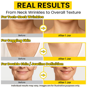 Chillihaer 8-in-1 neck firming cream jar open reveals rich, smoothing texture