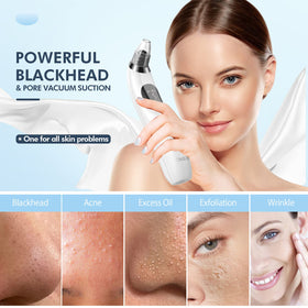 CHIMOCEE pore vacuum with five interchangeable probes for targeted skin care