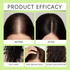 ChLNDalin serum dropper enables precise scalp nourishment application.