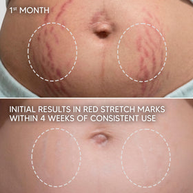 Cicatrissim cream texture close-up highlights quick absorption without oiliness.