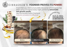 Cinnagrow daily-use routine shot highlighting lightweight oil.