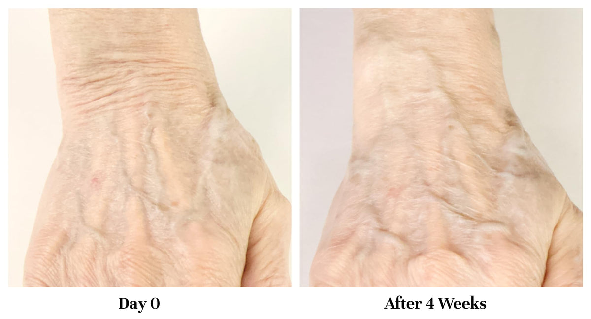 City Beauty Restoring Hand Treatment applied on hands for moisture
