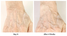 City Beauty Restoring Hand Treatment applied on hands for moisture