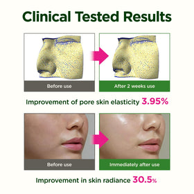 CKD fragrance-free formula offers gentle application for sensitive skin.