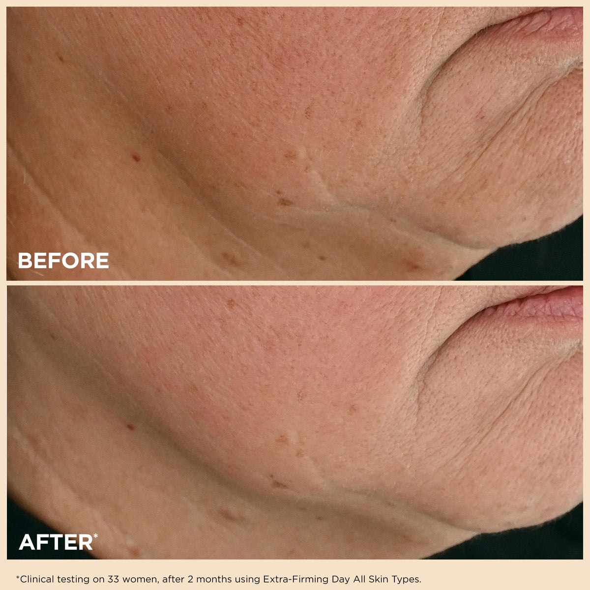 Applying Clarins Extra-Firming Day Moisturizer to the face with gentle press-and-release.