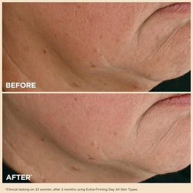 Applying Clarins Extra-Firming Day Moisturizer to the face with gentle press-and-release.