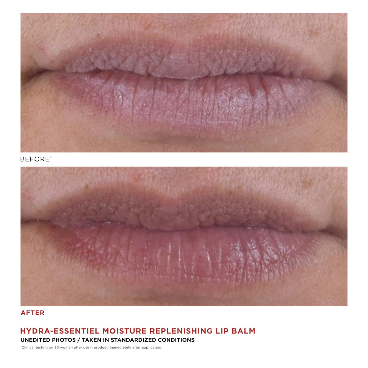 Clarins Hydra-Essentiel Lip Balm on lips showing smooth, hydrated skin.