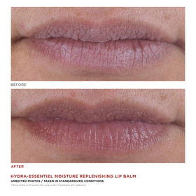Clarins Hydra-Essentiel Lip Balm on lips showing smooth, hydrated skin.