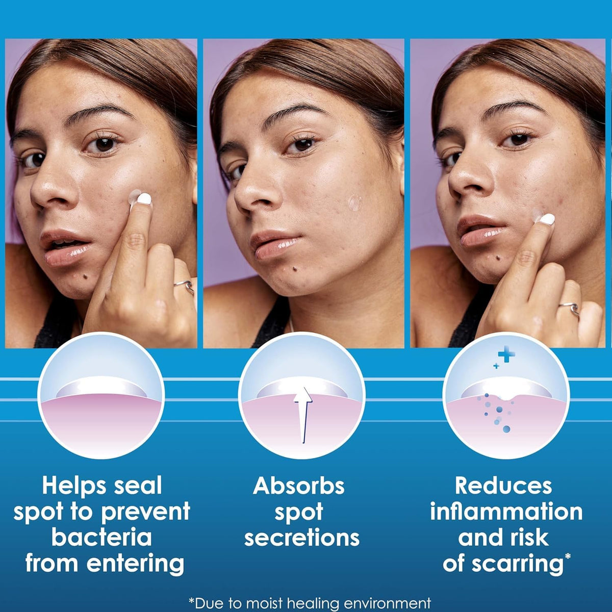 Clearasil hydrocolloid technology icon highlights moisture-based healing benefits.