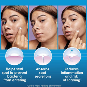Clearasil hydrocolloid technology icon highlights moisture-based healing benefits.