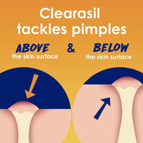 Close-up of Clearasil Stubborn Acne Control showing reduced acne marks