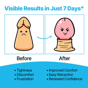 Clidelan cream application point demonstrates easy daily use and easing tightness
