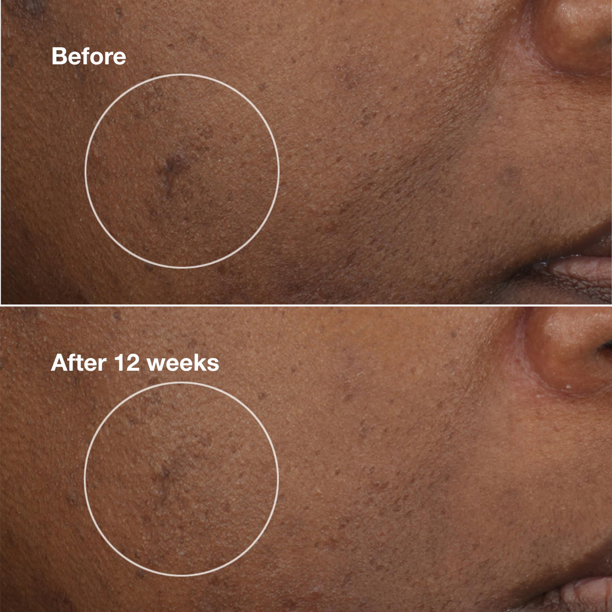 Clinique Even Better moisturizer packaging image emphasizes brightening complex ingredients.