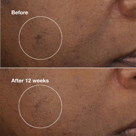 Clinique Even Better moisturizer packaging image emphasizes brightening complex ingredients.