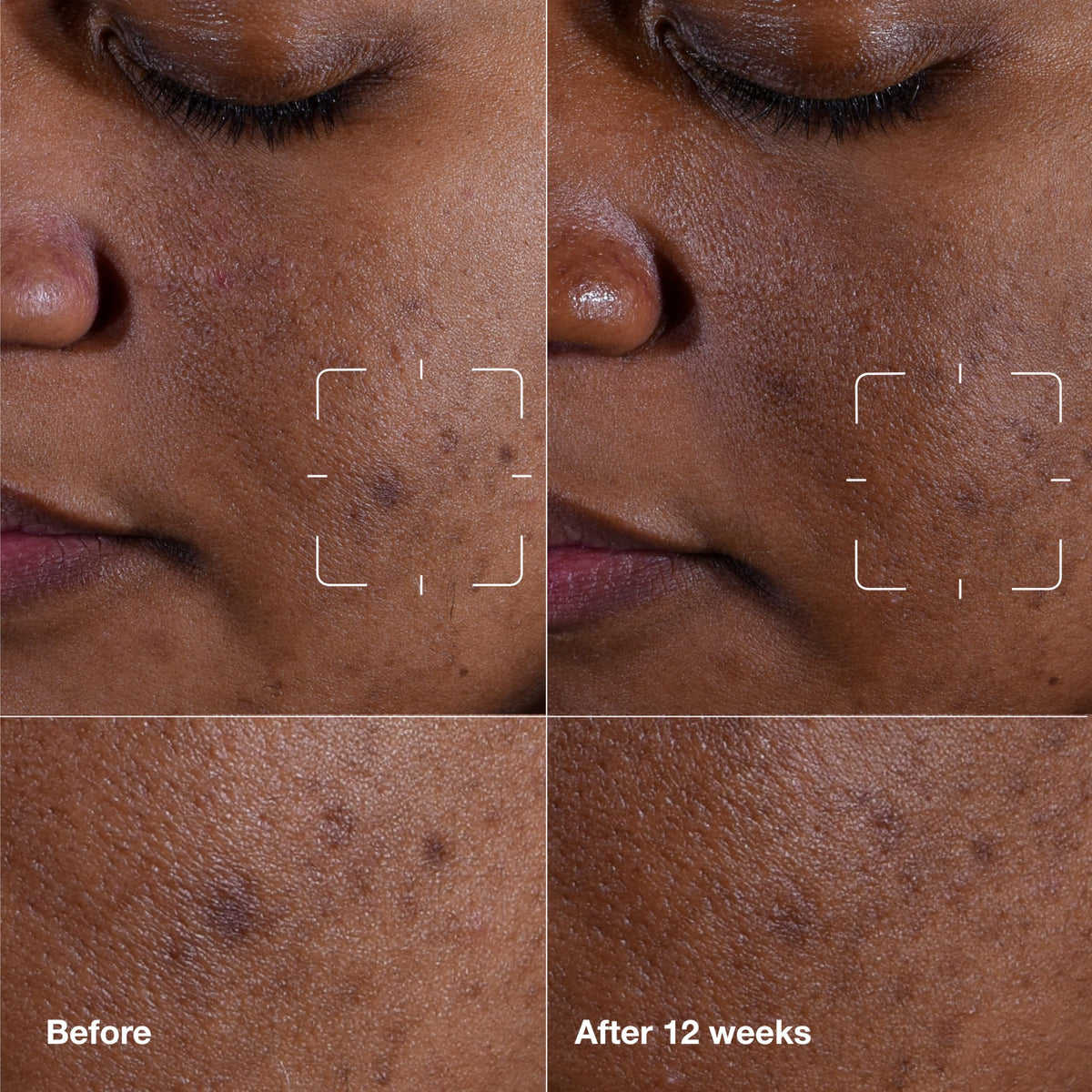 Clinique Even Better Clinical serum label highlights vitamin C and gentle formula.