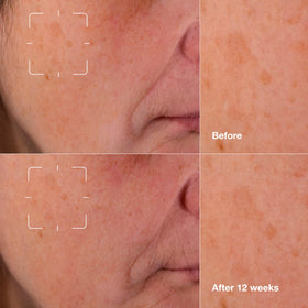 Clinique Even Better Clinical serum pump for controlled application and even tone.
