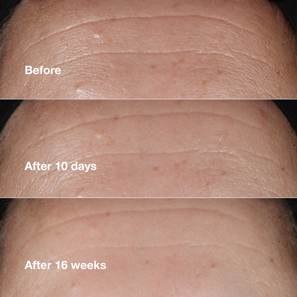 Clinique Smart Clinical Repair travel-size packaging for on-the-go routine.