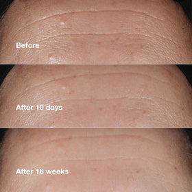 Clinique Smart Clinical Repair travel-size packaging for on-the-go routine.