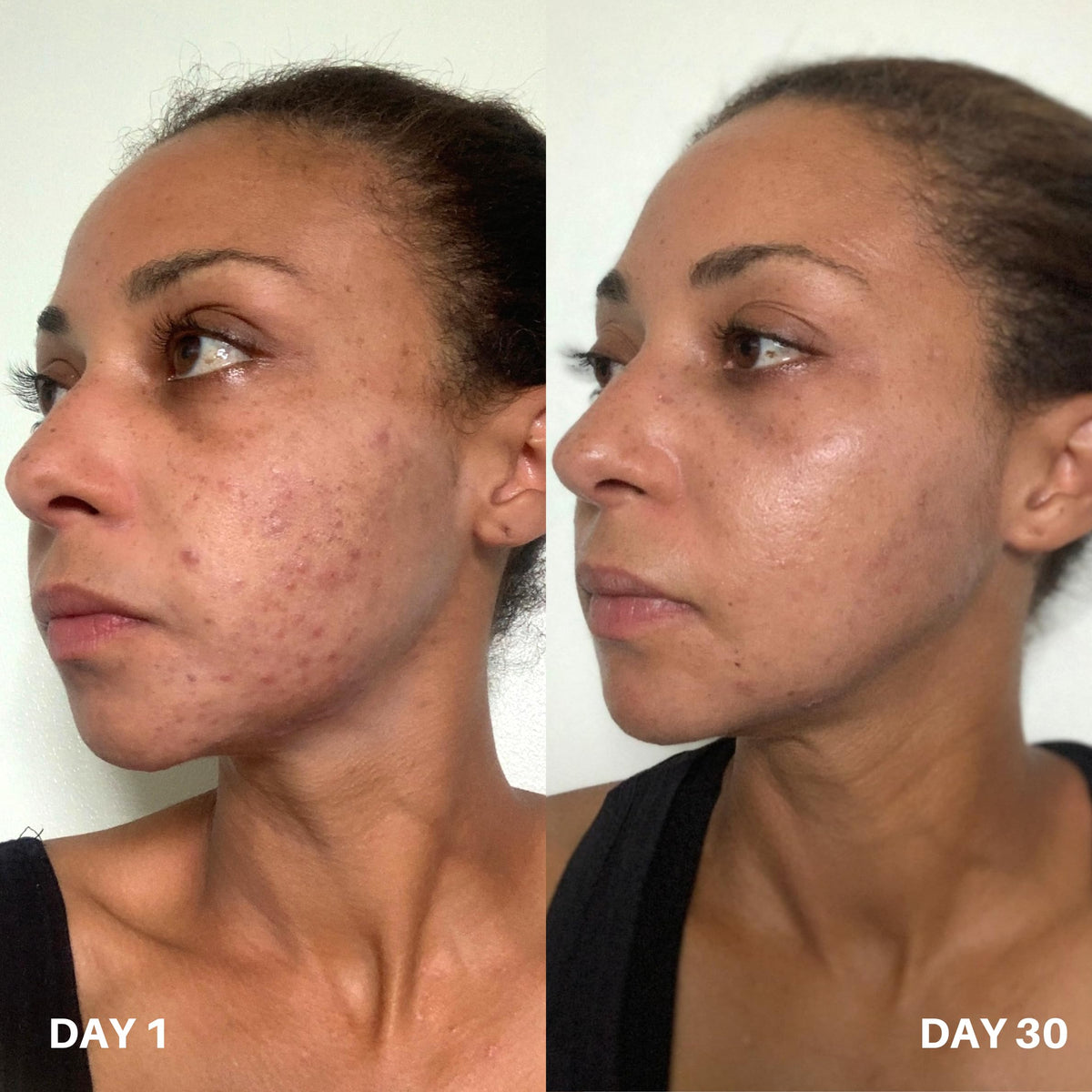 Clinisoothe+ Face and neck spritz demonstrates simple daily routine