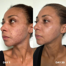 Clinisoothe+ Face and neck spritz demonstrates simple daily routine
