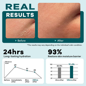 CMYYDX applying the cream on hand for daily skincare.
