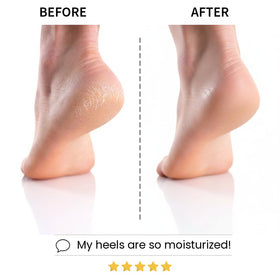 Codi New York Hydrated feet after treatment feel smoother