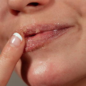 Colleen Rothschild Sugar Lip Scrub before and after texture improvement on lips.