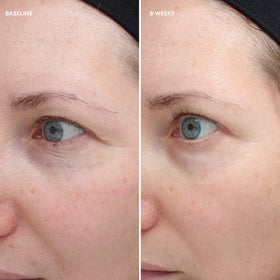 Blend of peptides and antioxidants in Colorescience Total Eye supports firmness.