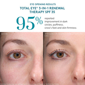 Colorescience Total Eye makeup-primer compatibility enables easy makeup application