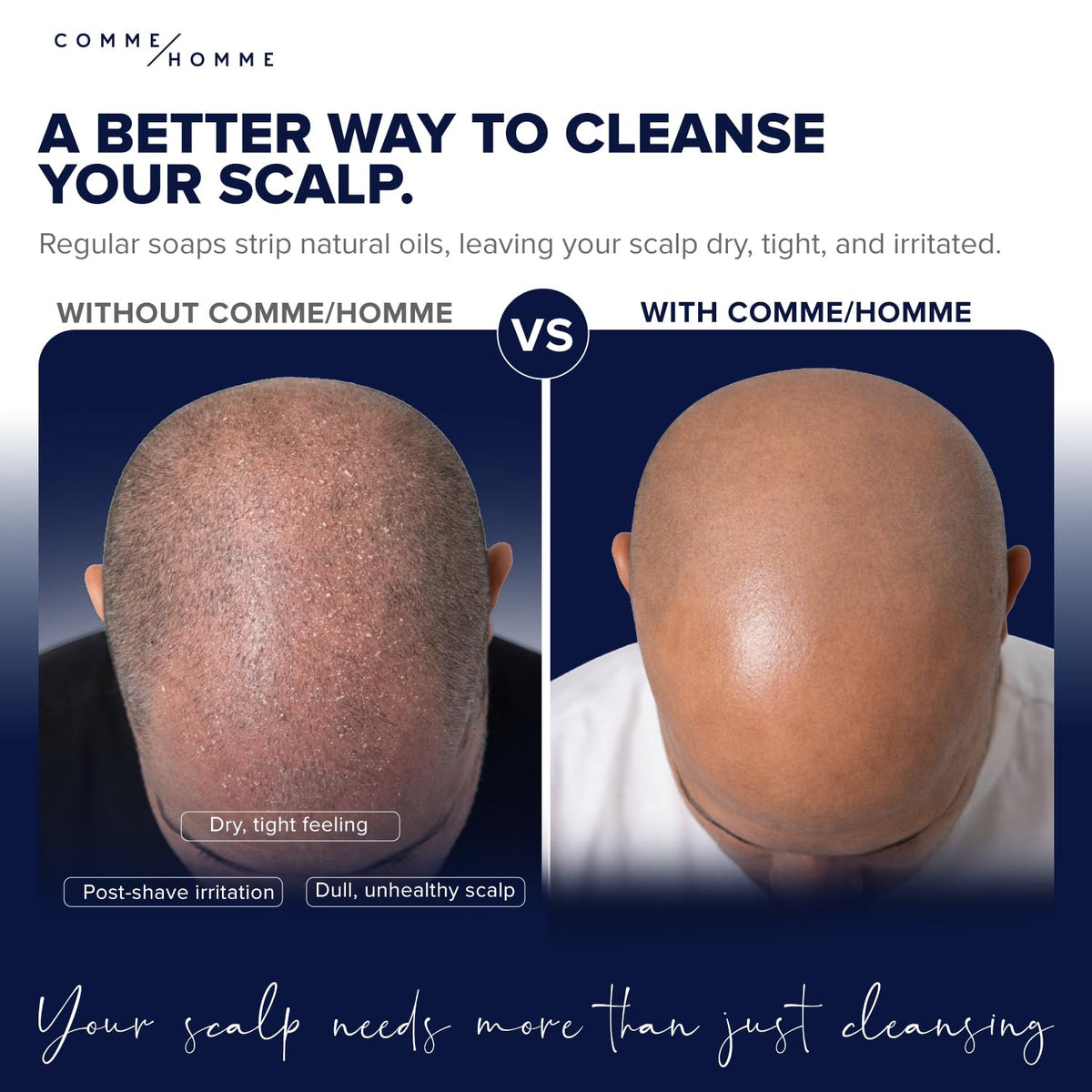 Comme Homme Hydrating Scalp Wash pump top highlights caffeine boost for energized scalp.