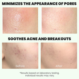 ConfidMiss Centella Acne Clay Stick ingredients highlighting soothing balance.