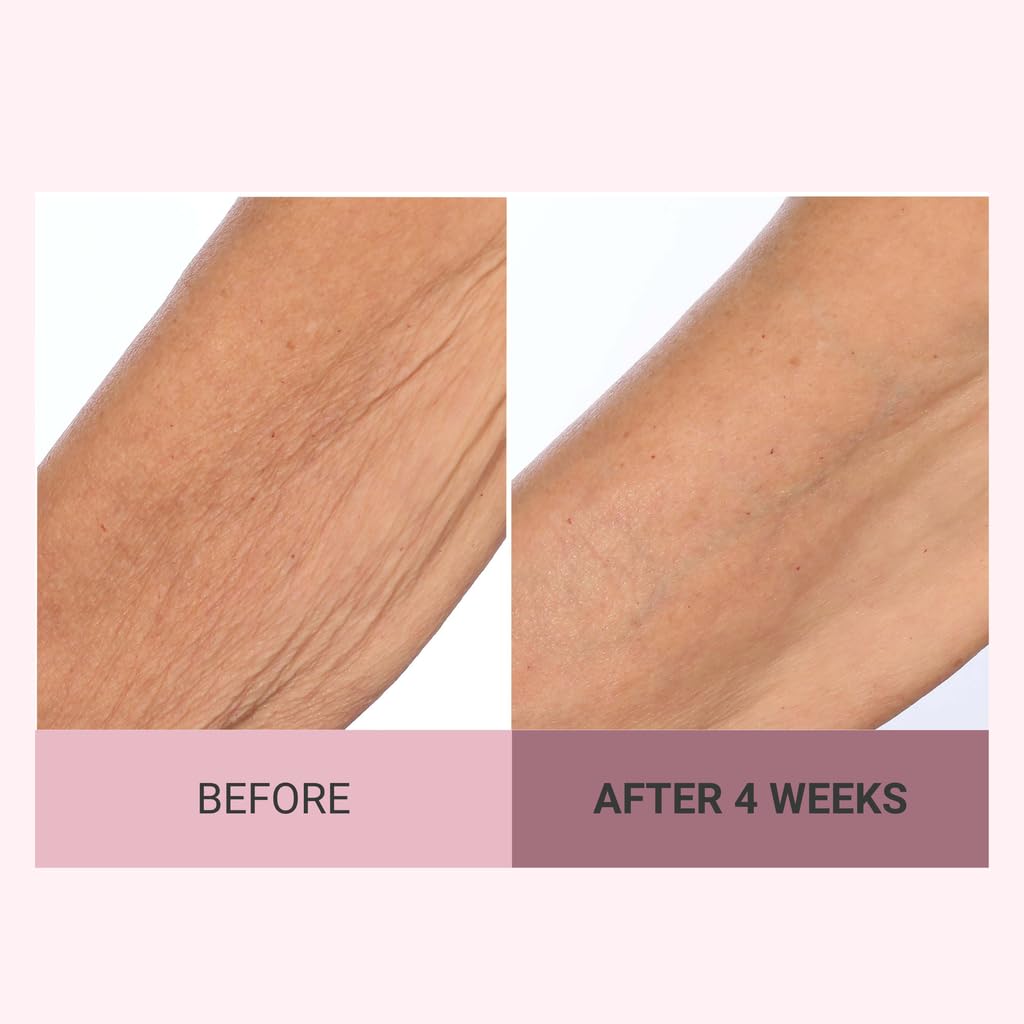 Hydration boost for dry legs and arms with Consult Beaute cream.