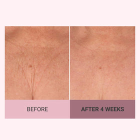 Pink PepperSlim in action aiding microcirculation for a slimmer look.