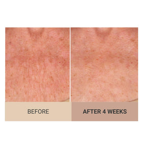 Consult Beaute Unscented Champagne Lift cream on arm smooths and hydrates.