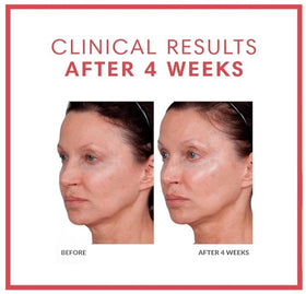Volumagen serum used during the day with quick absorption