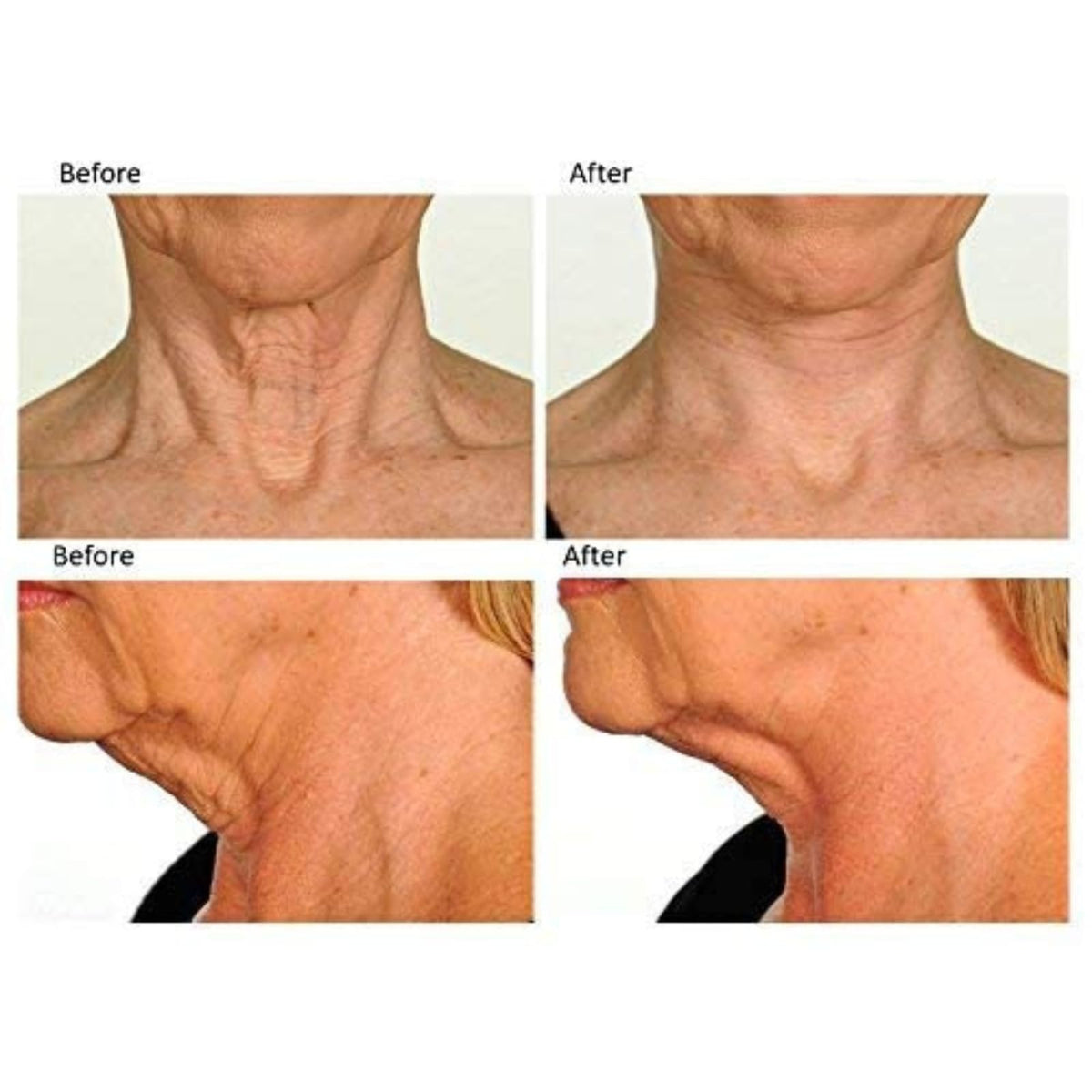 Contours Rx lightweight neck-lift detail demonstrates invisible finish under daily attire.