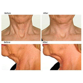 Contours Rx lightweight neck-lift detail demonstrates invisible finish under daily attire.