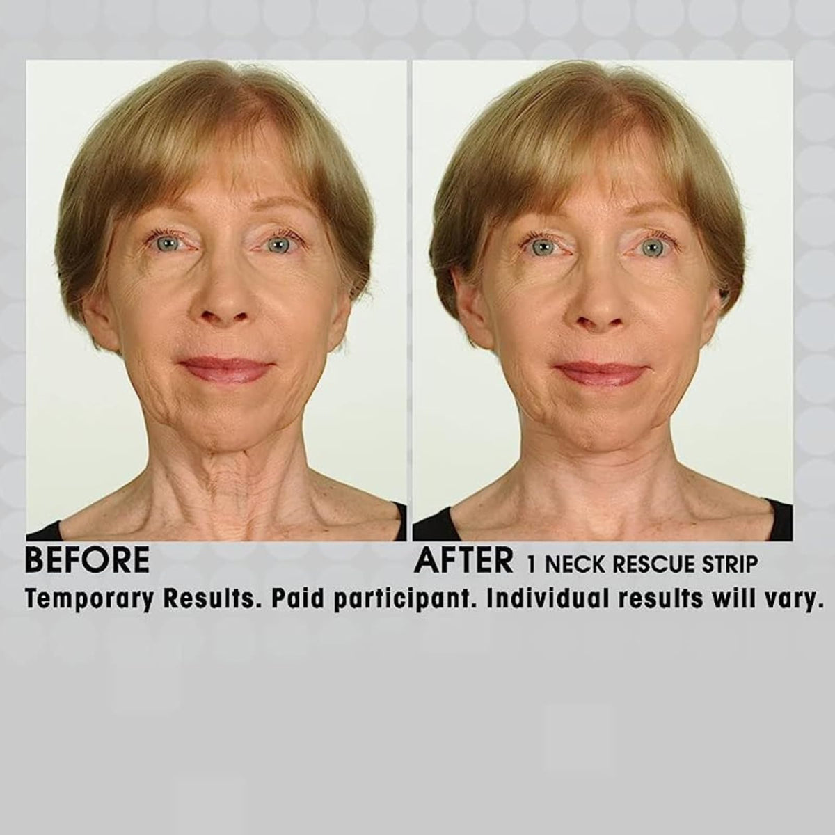 Contours Rx turkey-neck-smoothing strips reduce visibility under hair and clothing.