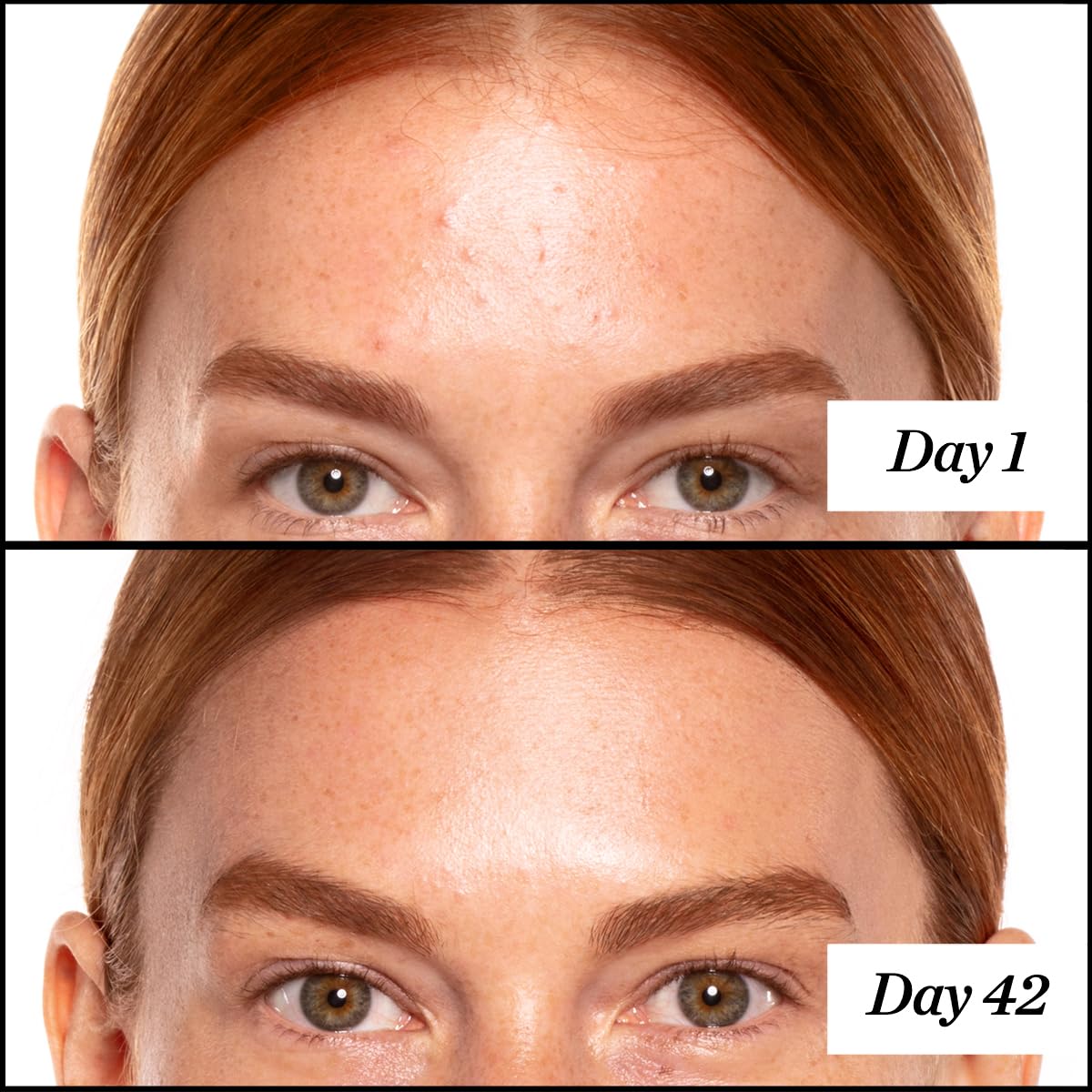 Encapsulated CoQ10 detail within the A+ retinoid formula
