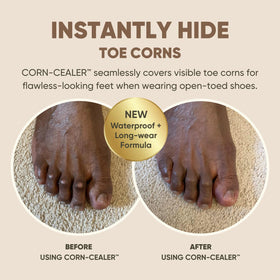 CORN-CEALER lightweight waterproof formula blends invisibly with skin.