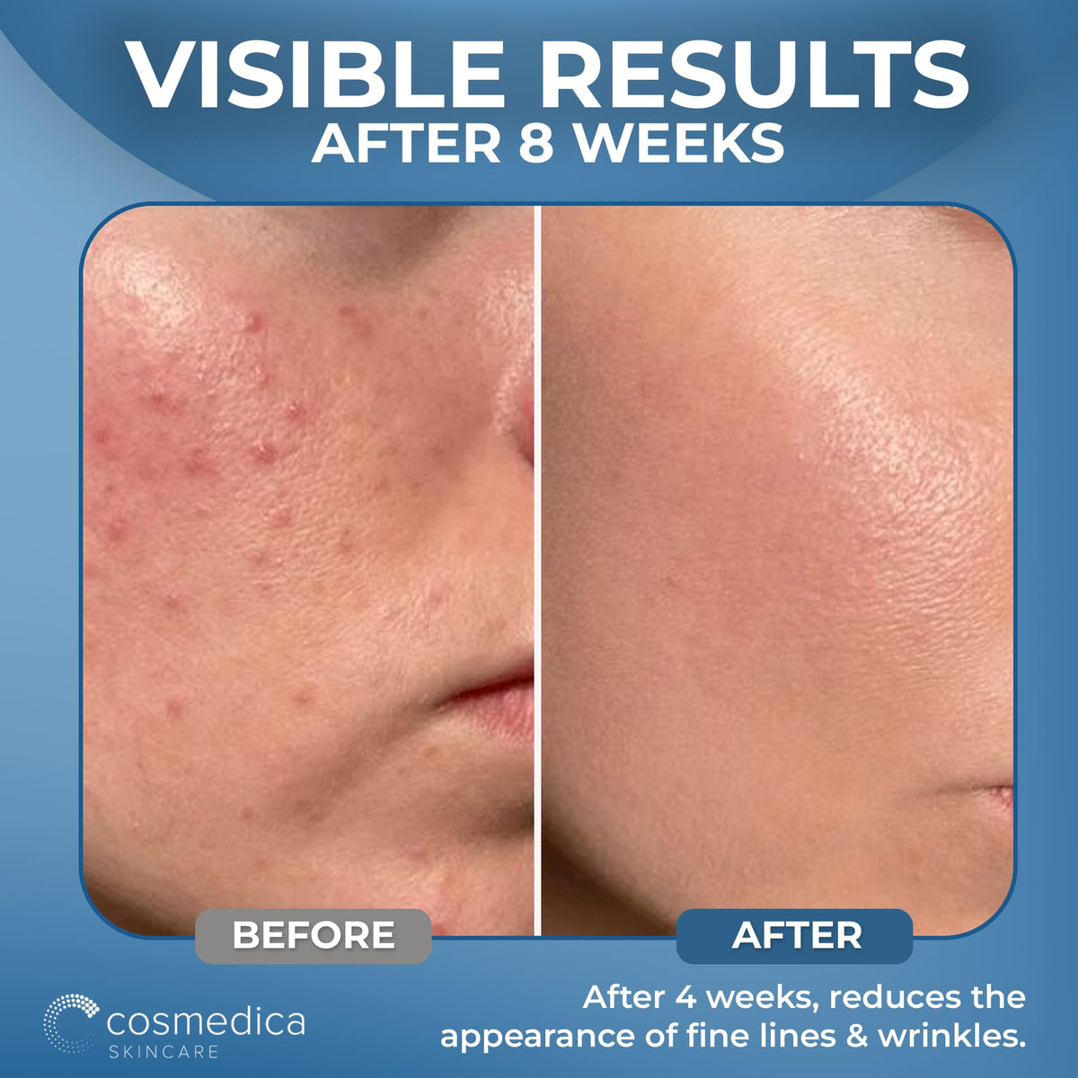 Cosmedica Hyaluronic Acid Serum box, clean and paraben-free