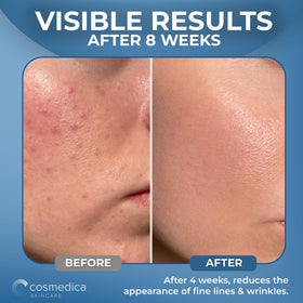 Cosmedica Hyaluronic Acid Serum box, clean and paraben-free