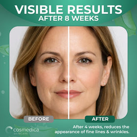 Cosmedica Retinol Serum applying on facial skin during routine